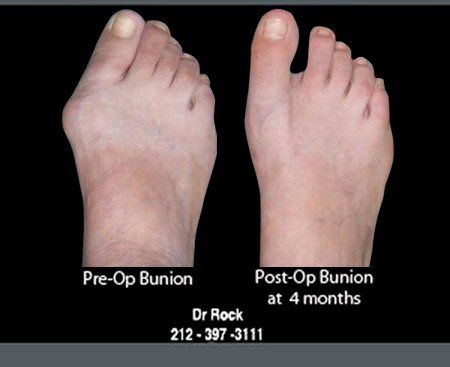 Before and after footwork