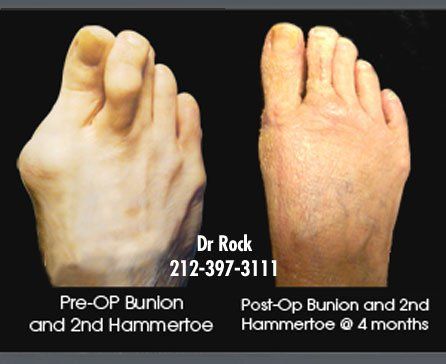 Before and after footwork