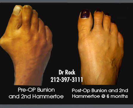 Before and after footwork