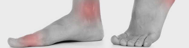 Tendinitis