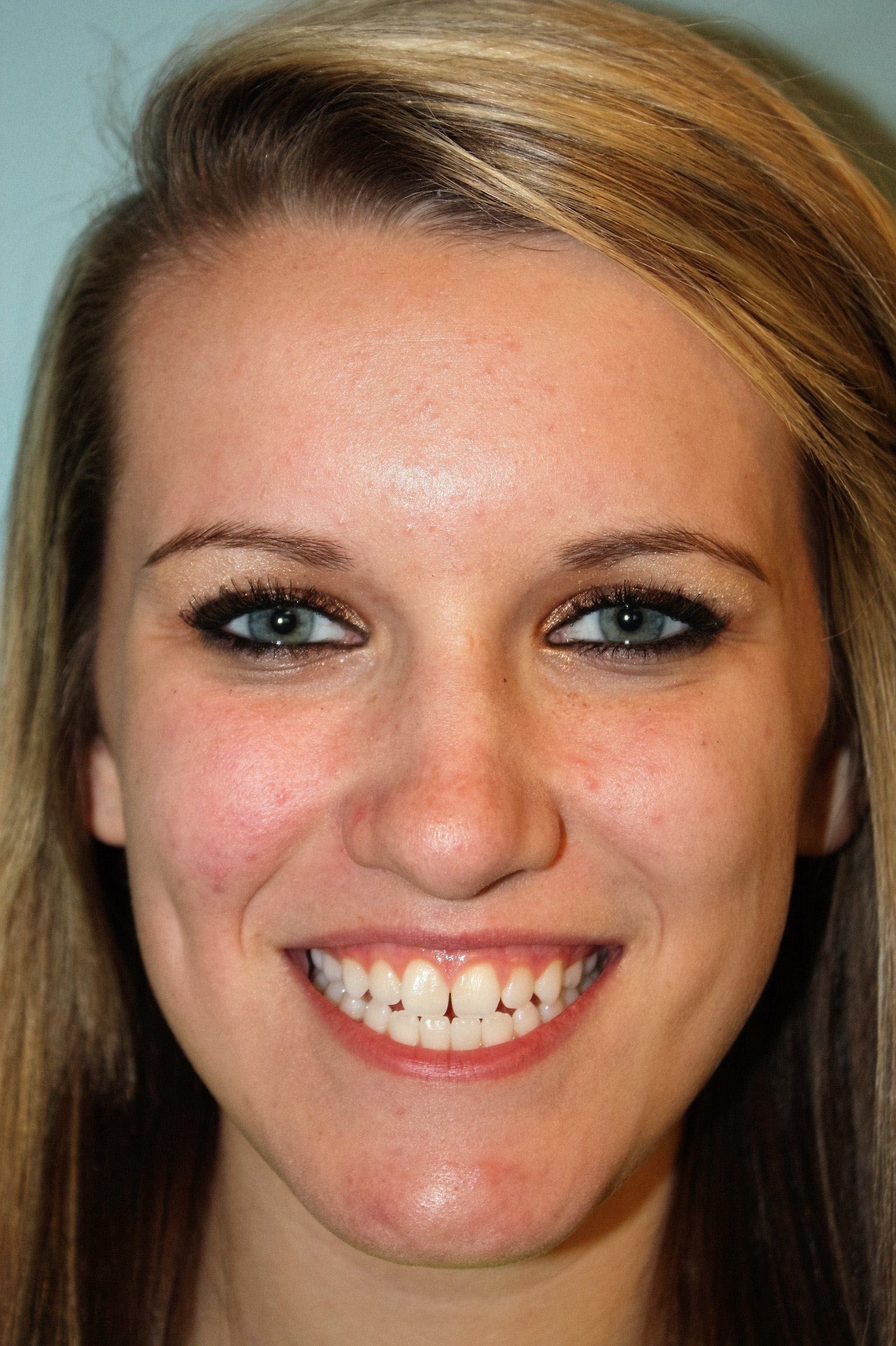 A woman before dental treatment