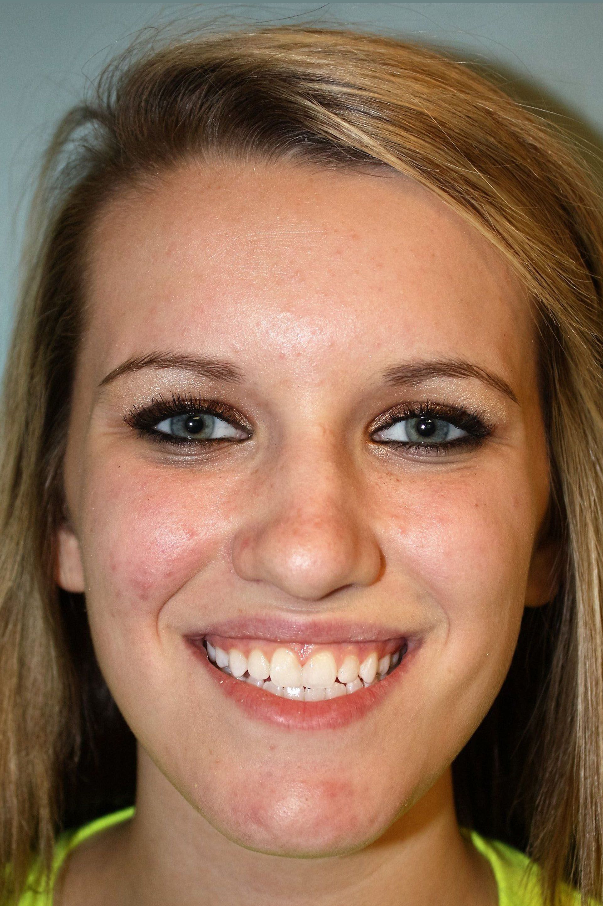 A woman after dental treatment