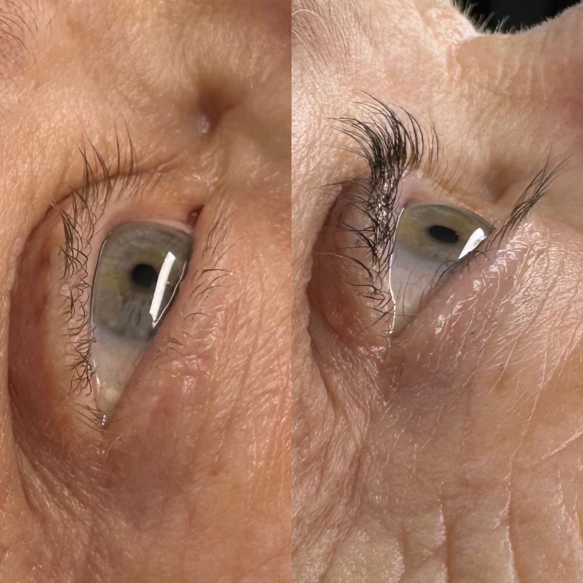 A before and after picture of a woman 's eye.