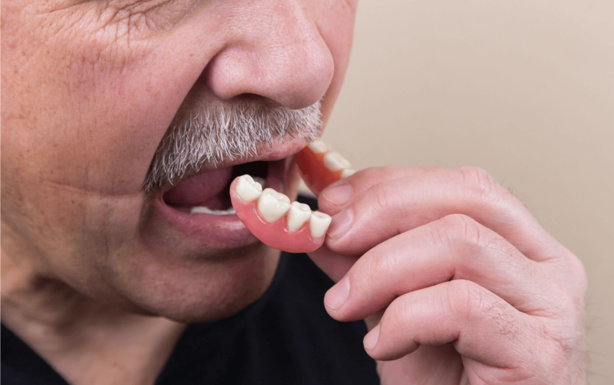 Man putting in dentures