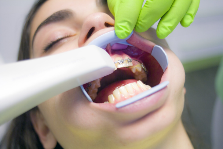 Women getting dental mouth X-rays
