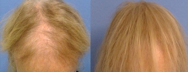 A before and after photo of a woman 's hair.