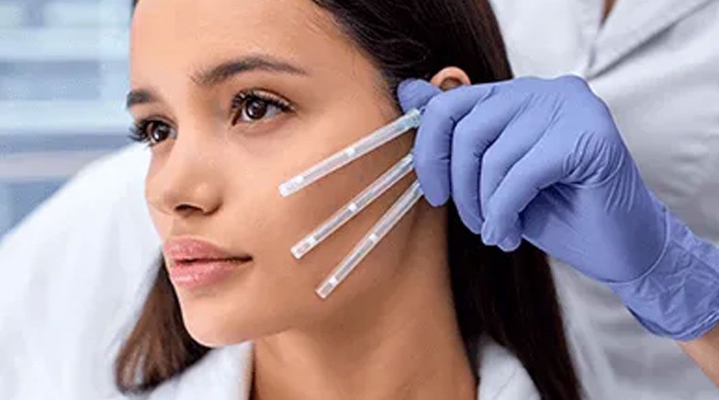Gloved hand applying facial treatment to woman’s cheek with three small microneedles