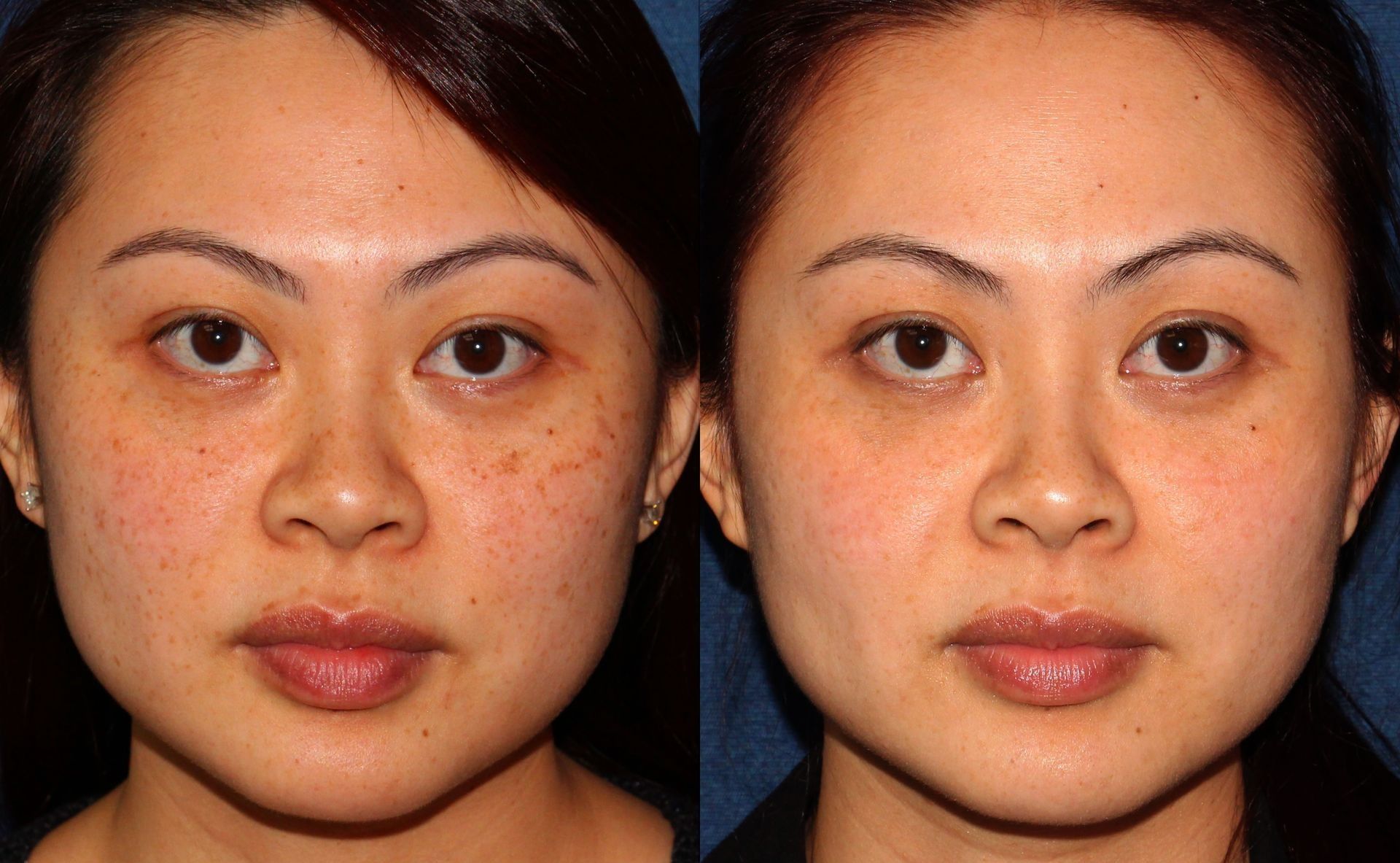 Side-by-side portrait of the same woman with a neutral expression against a dark background