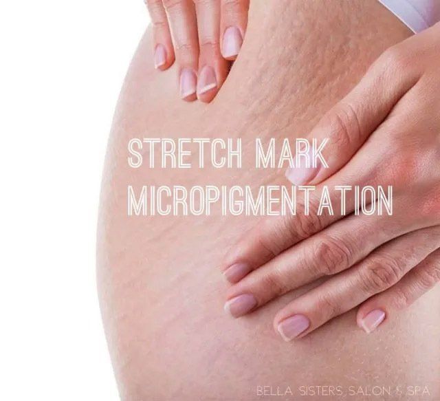 Scar Camouflage Scar Treatment Natick, MA