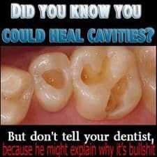 Close-up of teeth with cavities; text claims cavities can be healed, but don't tell your dentist.