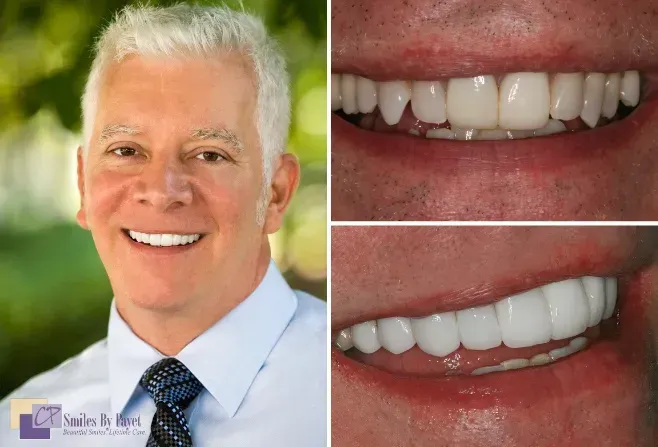 Man with a bright smile next to close-ups of teeth, possibly a dental patient.