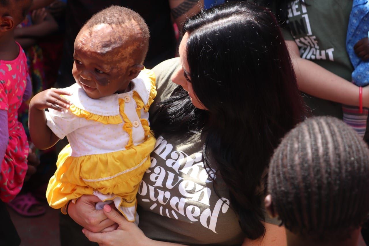 Woman holding a child with a visible injury, possibly a burn. Both are surrounded by other people.