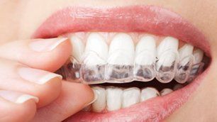 A Touch of Class Dentistry | Dentist | Olympia Fields, IL