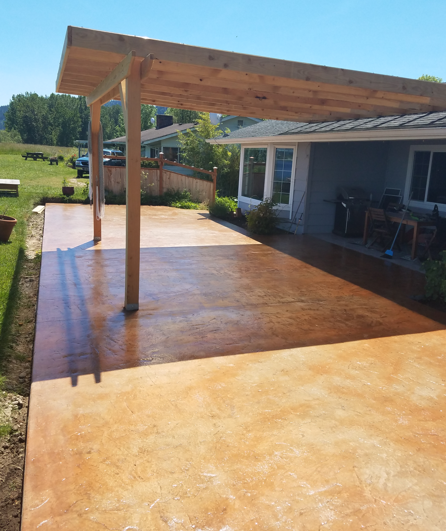 Wooden patio deck with pergola beside a house, sunlit and overlooking a grassy yard.