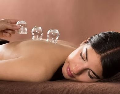 Woman receiving cupping therapy on her back; clear cups suctioned to skin.