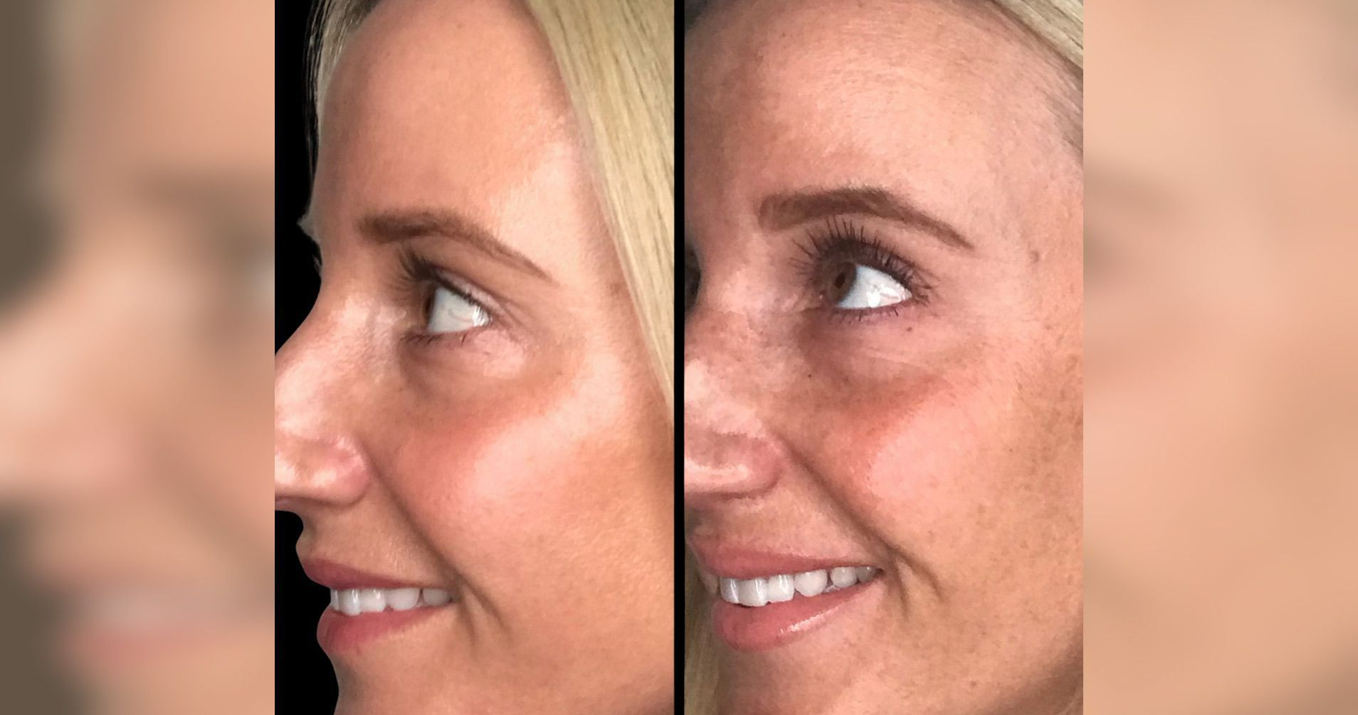 A before and after photo of a woman's face.