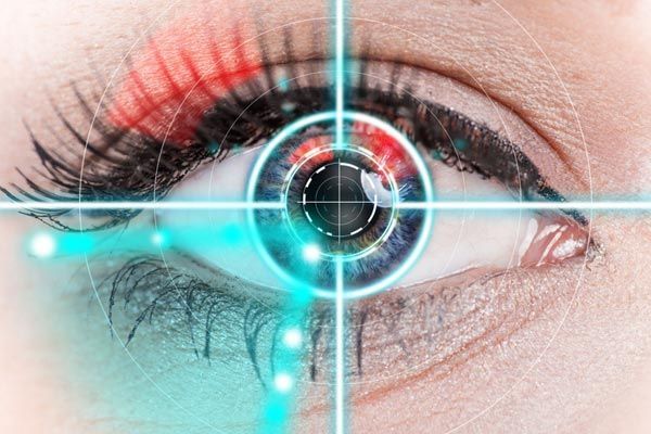 Cataract/Lens Implant Surgery