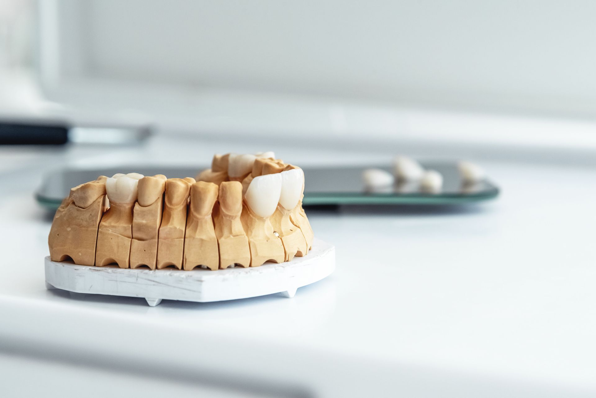 The Practical Advantages of Porcelain Crowns According to a Family Dentist