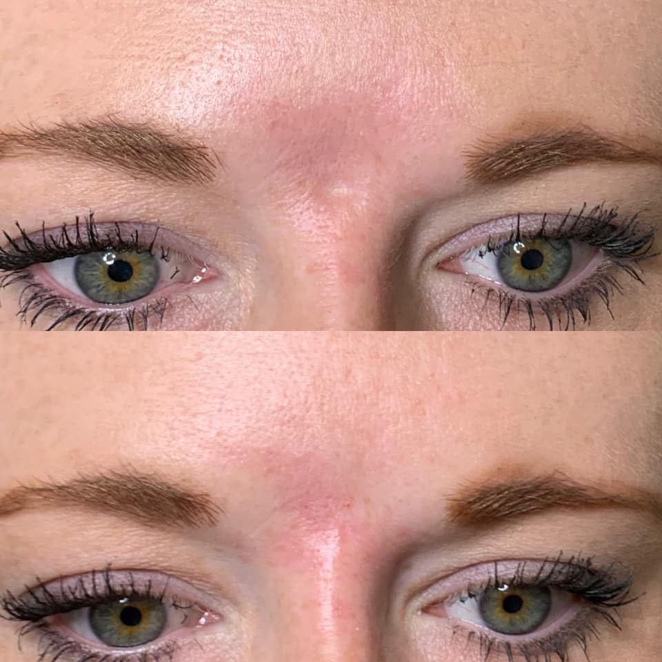 Face before and after