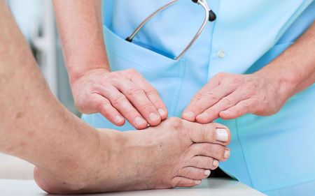 bunion treatment