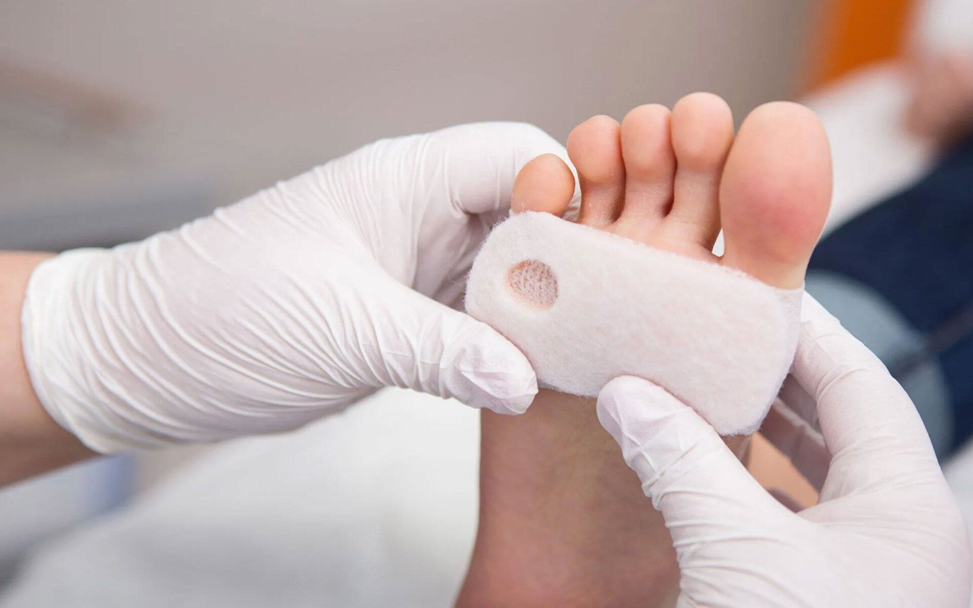 diabetic foot care