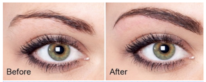 Before and after eyebrow service