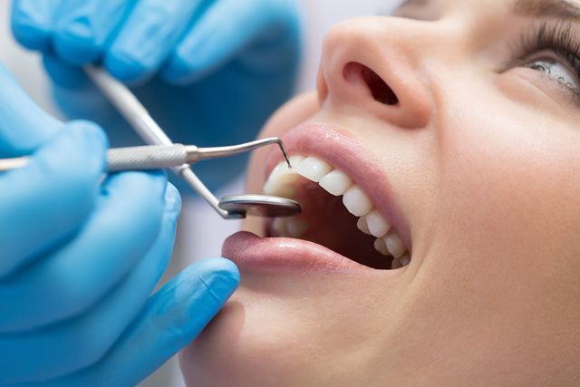 A close up of a woman 's teeth with a tooth color chart.