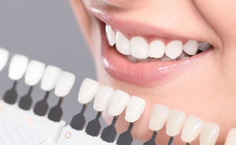 Woman cosmetic dentistry
