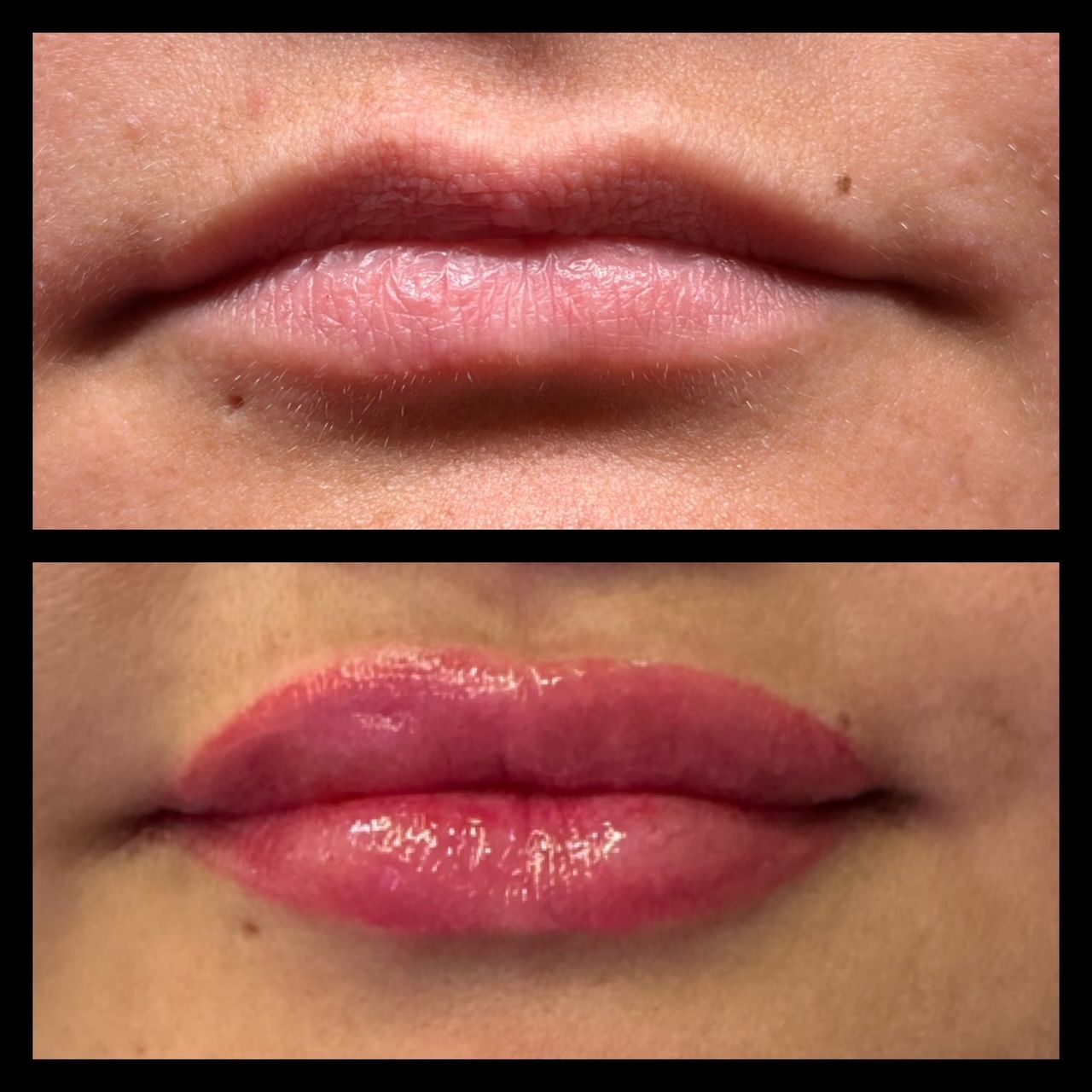 A before and after picture of a woman 's lips.