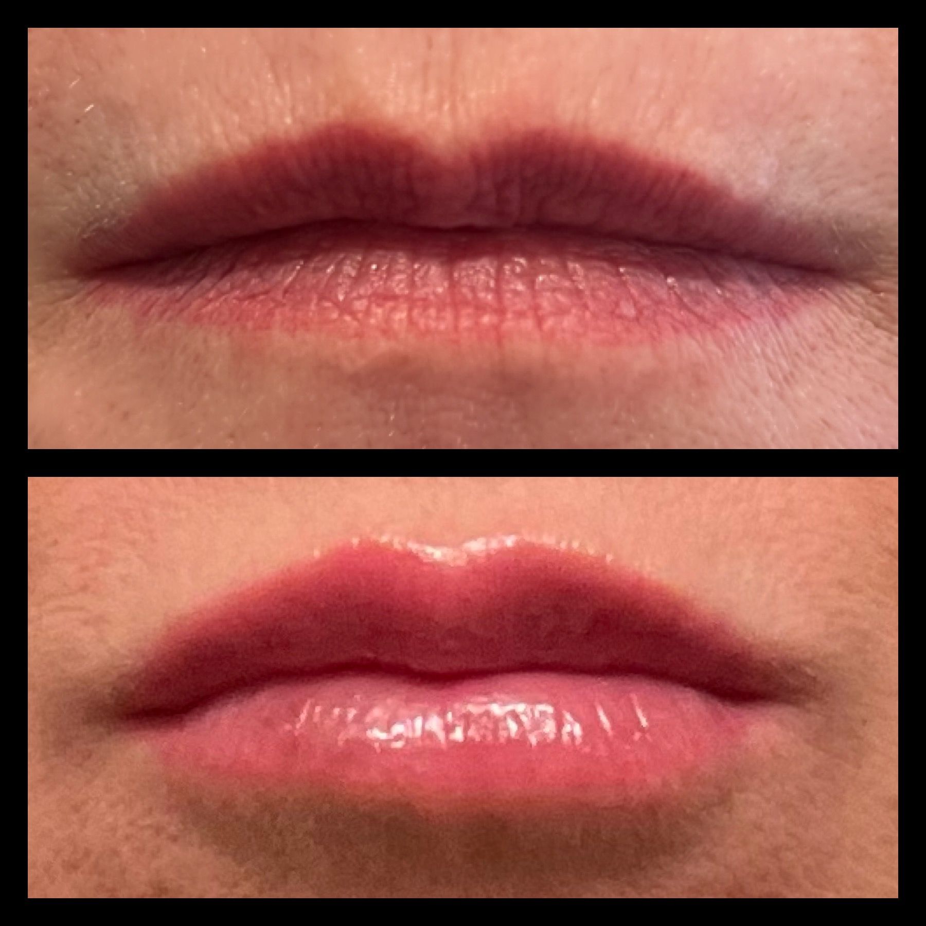 A before and after picture of a woman 's lips.