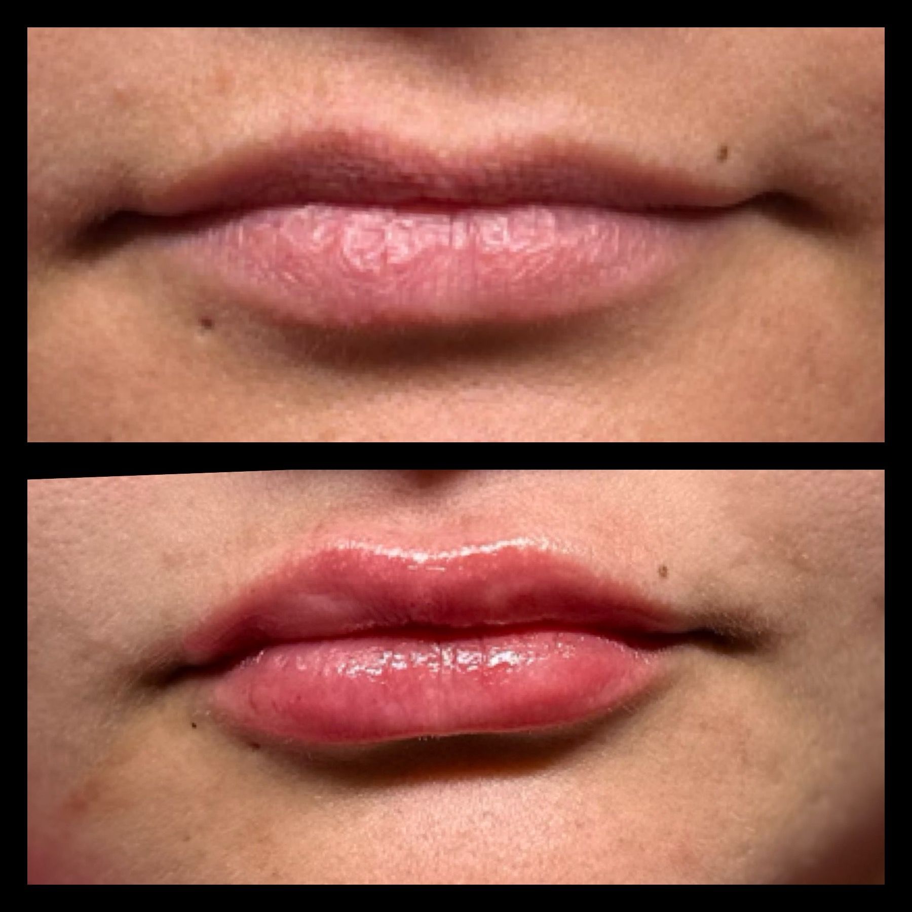 A before and after photo of a woman 's lips.