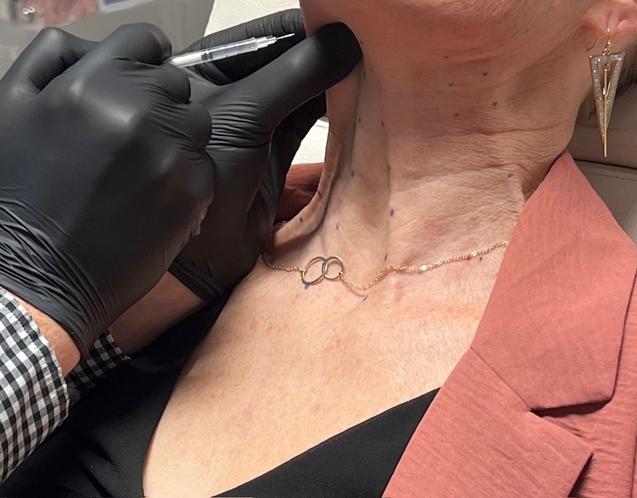 A woman is getting a botox injection in her neck