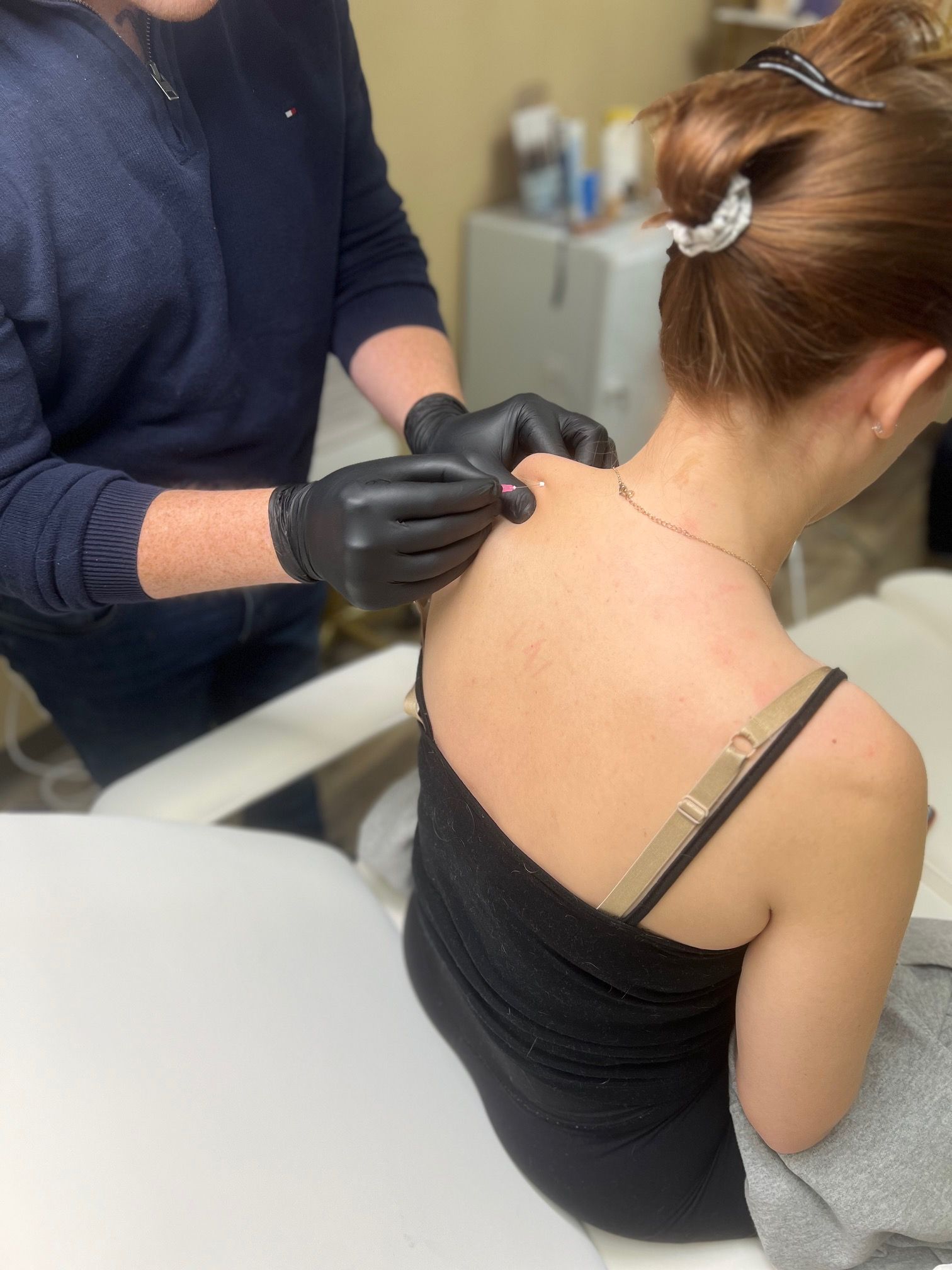 Polydioxanone threads treatment on the woman wearing black tops