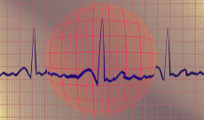 Electrocardiogram strip