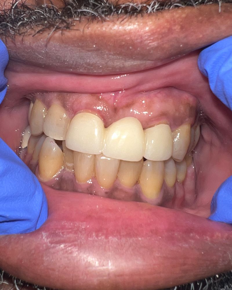 Restorative Dentistry - After