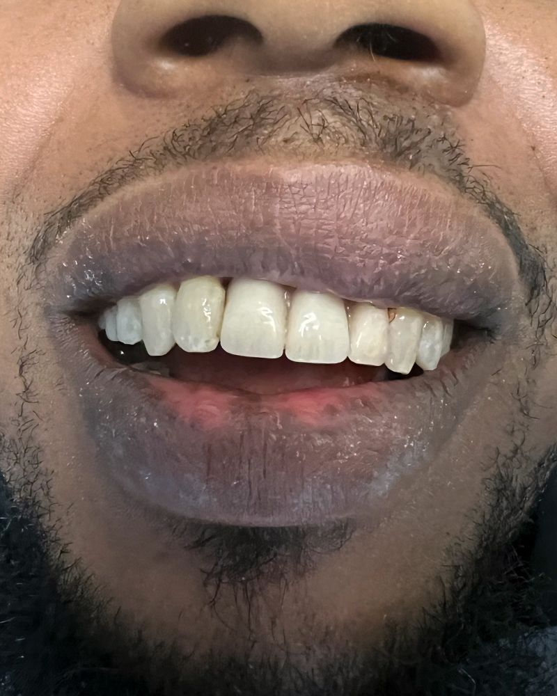 Restorative Dentistry - After