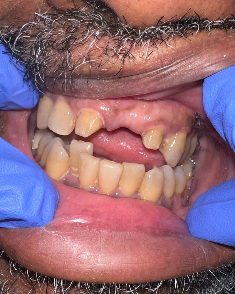 Restorative Dentistry - Before