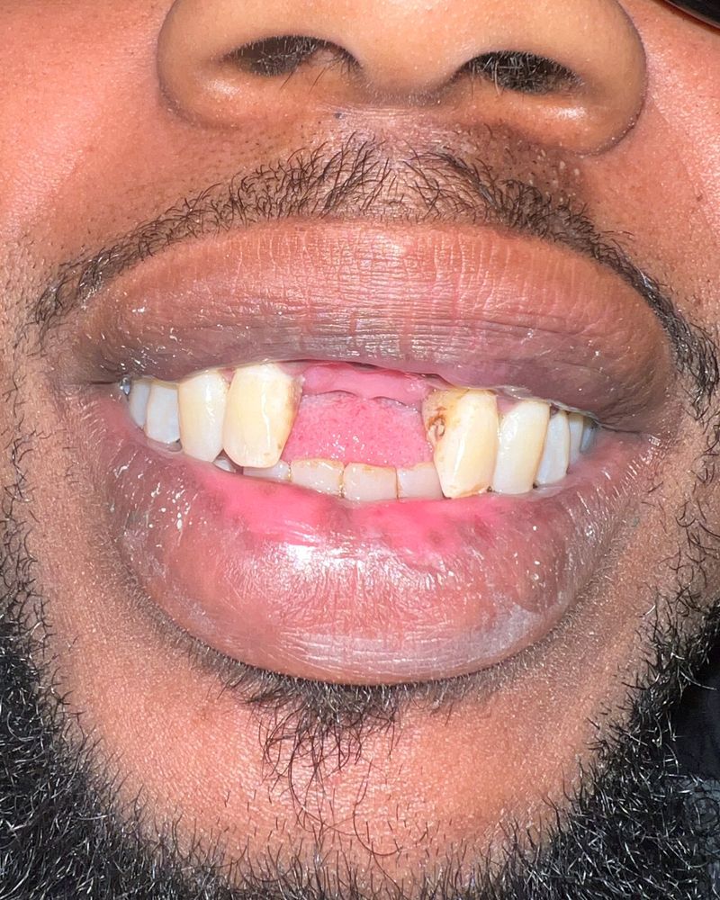 Restorative Dentistry - Before
