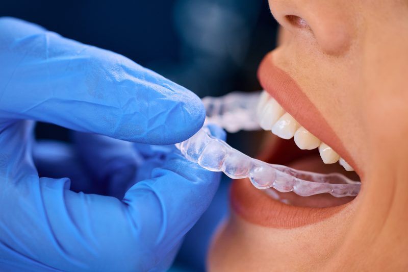 A woman is getting her teeth whitened by a dentist.