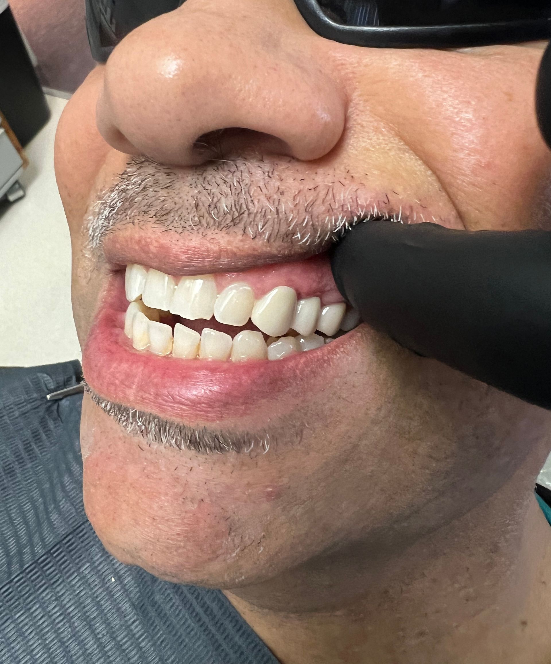 Restorative Dentistry - Before