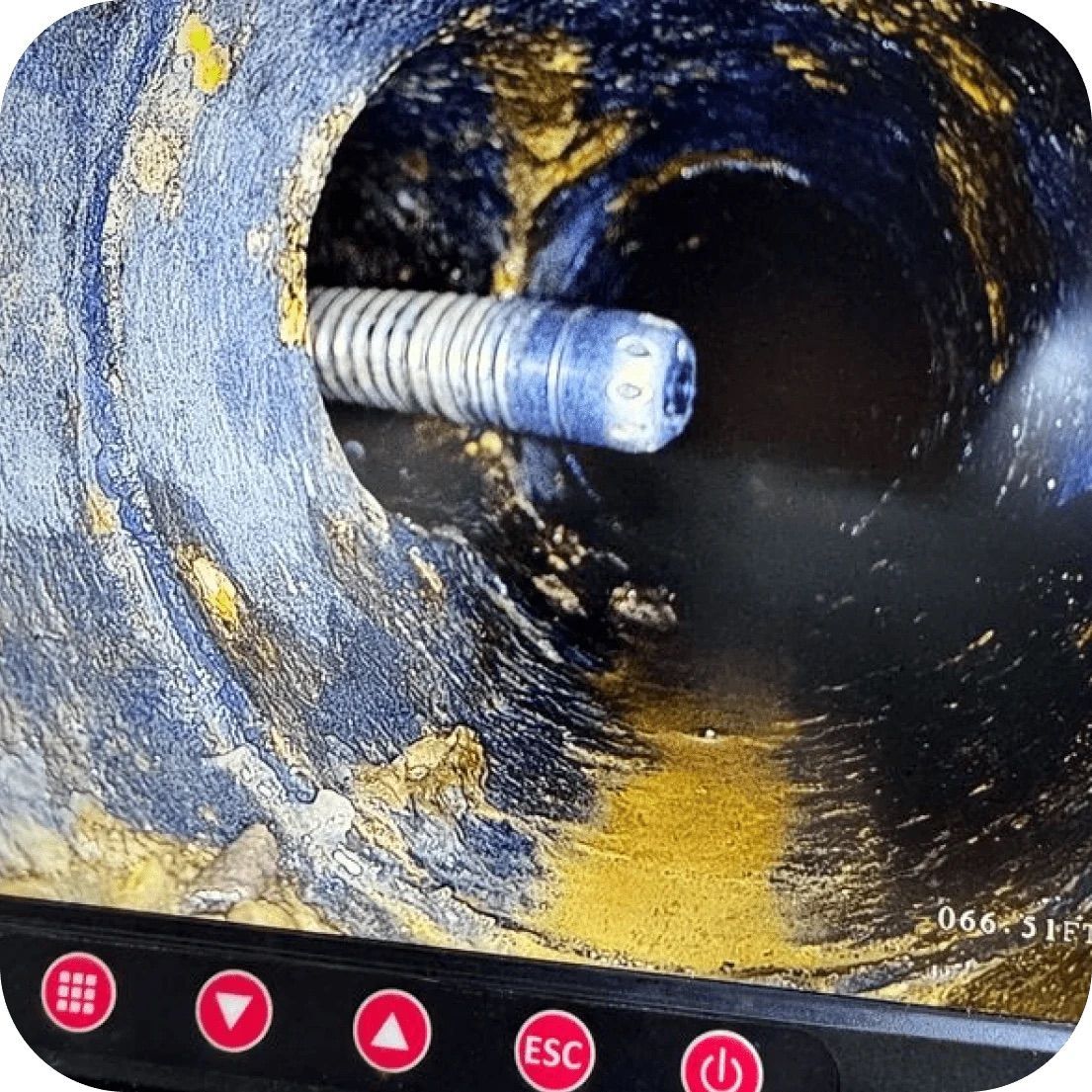 A close-up view of an endoscope entering a body cavity, the inner wall showing abstract blue and gold patterns.