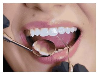 Dental x-ray of patient
