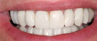 Close-up of a smiling mouth with white teeth and pink lips