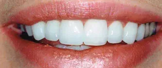 Close-up of a smiling mouth with white teeth and pink lips