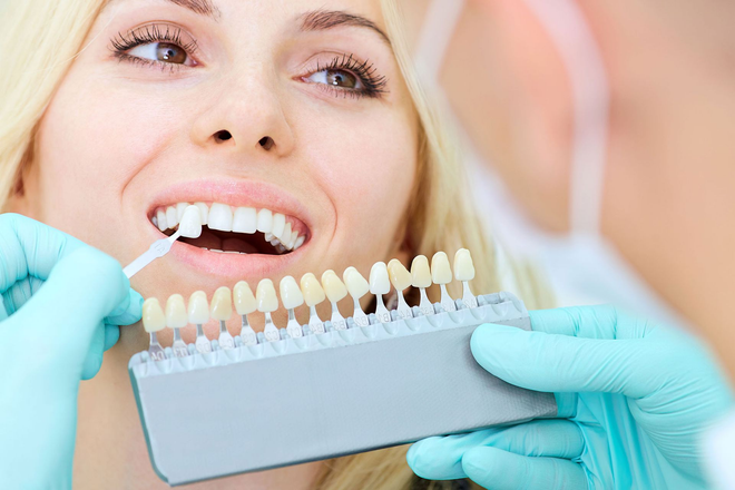 Dentist holding teeth shade guide near smiling patient during cosmetic dental consultation