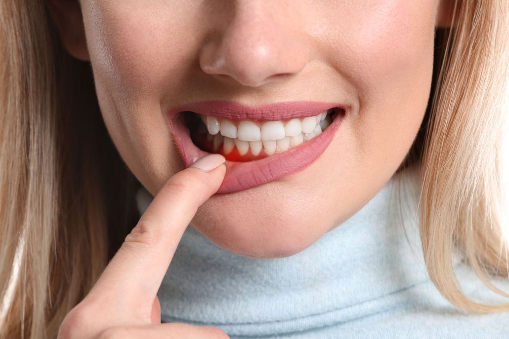 Close-up of smiling mouth with a finger pointing to teeth, showing a light blue turtleneck sweater