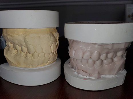 Complete dentures