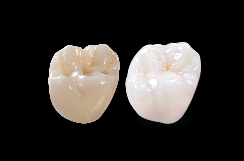 dental implant dentists decatur il