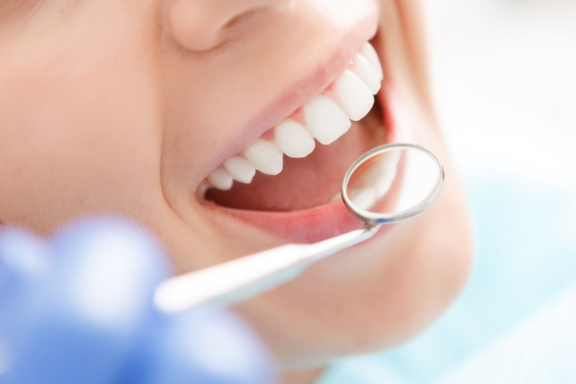 Dental restoration