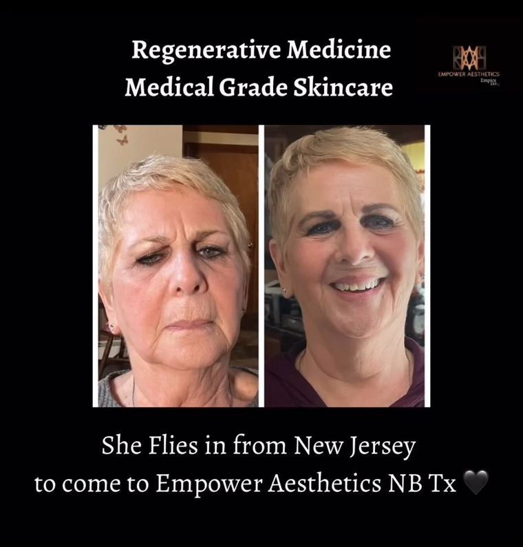 No Tox, Only Regenerative Medicine and Empowers Skincare